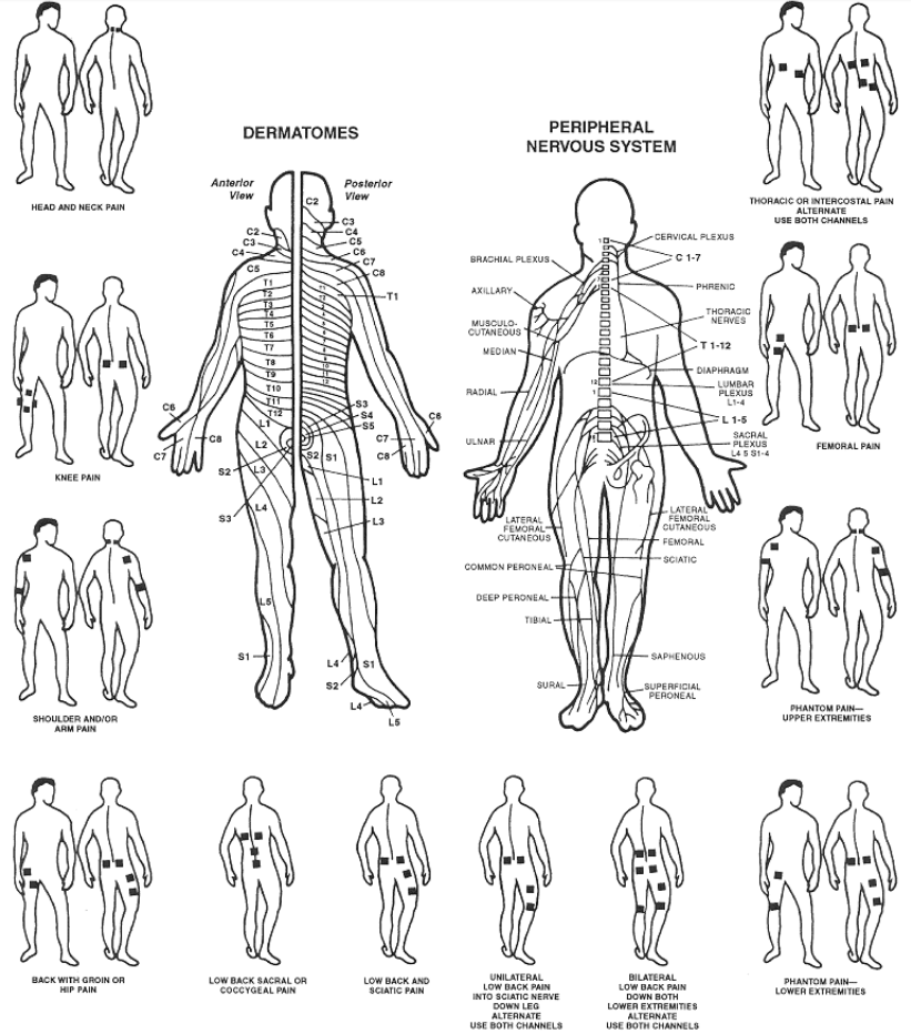 diagram for tens unit   A transcutaneous electrical nerve stimulation (TENS) unit is a battery-operated device that may help treat period pain, arthritis,