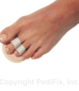 PediFix® Podiatrists' Choice® Double Toe Straightener - Pink , S