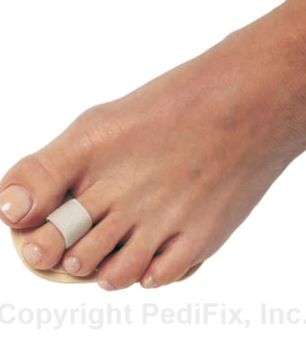 PediFix® Podiatrists' Choice® Toe Straightener - White, S