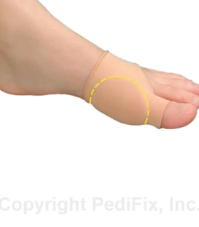 Visco-GEL® Bunion Relief Sleeve - Yellow, S, none, none