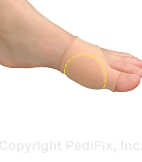 PediFix® Visco-GEL® Bunion Relief Sleeve - Yellow, S