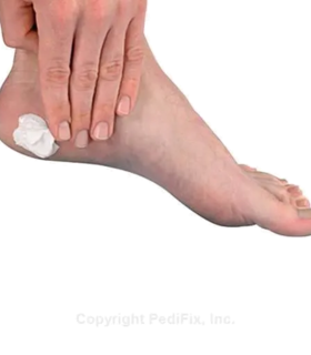 Podiatrists' Choice® Callus Control Cream™ - White, M, none, none