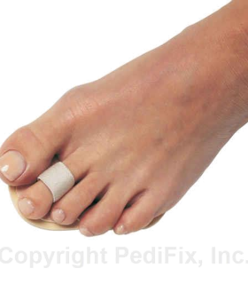  Podiatrists' Choice® Toe Straightener PediFix - White, S, none, none