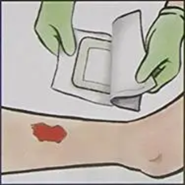 Border Gauze Adhesive Island Wound Dressing - MSC3236Z