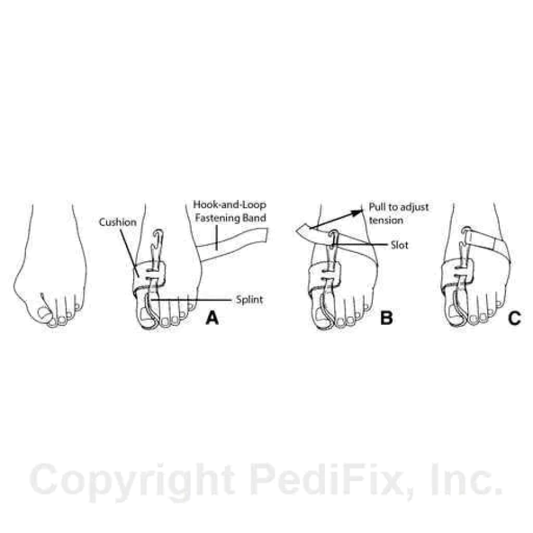 Nighttime Bunion Regulator™ P6035-LL