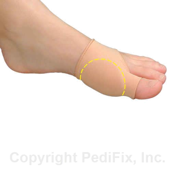 PediFix® Visco-GEL® Bunion Relief Sleeve 2 - P1303-L