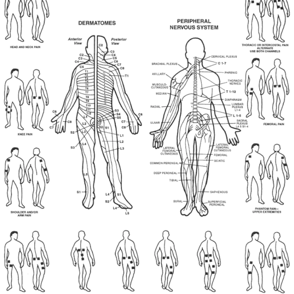 Ultima 5 Digital u5 t Dual Channel Tens Unit PMT 858563006171