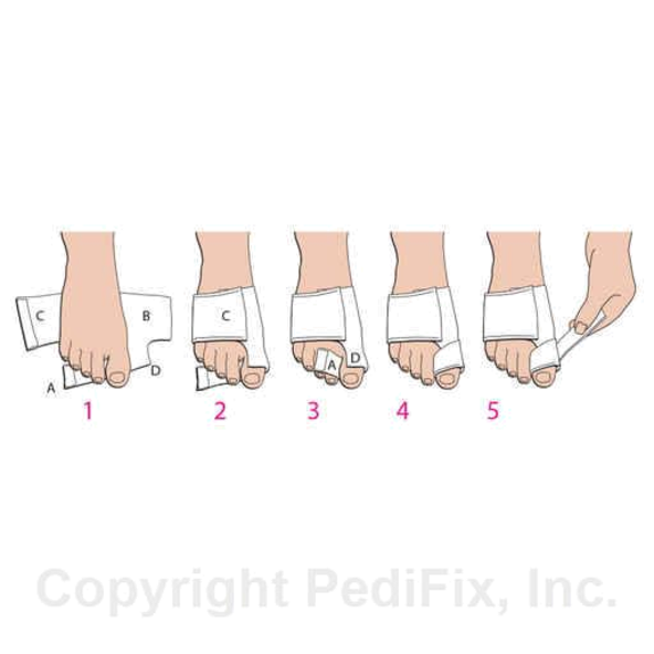 soft, fabric splint pedifix - P6026-ML